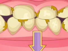 खेल Bad Teeth Makeover ऑनलाइन