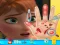 खेल Anna hand doctor ऑनलाइन