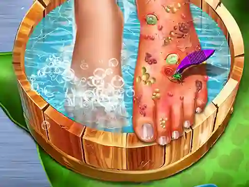 खेल Feet Skin Doctor ऑनलाइन