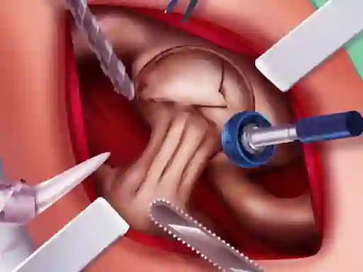खेल Princess Hips Surgery ऑनलाइन